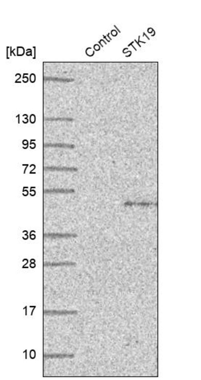 Anti-STK19 antibody produced in rabbit