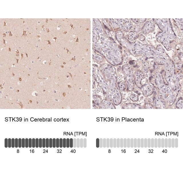 Anti-STK39 antibody produced in rabbit
