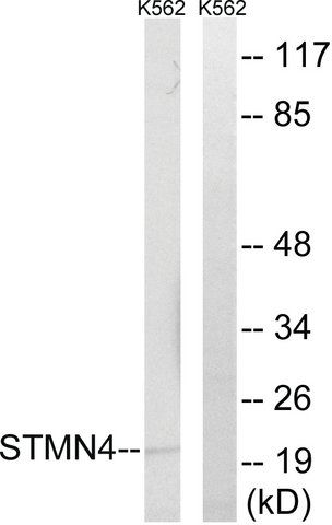 Anti-STMN4, C-Terminal antibody produced in rabbit