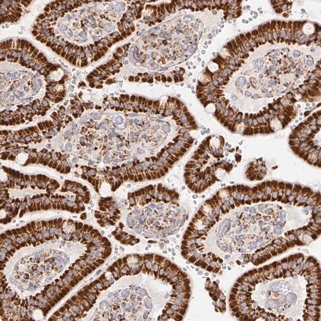 Anti-STOML2 antibody produced in rabbit