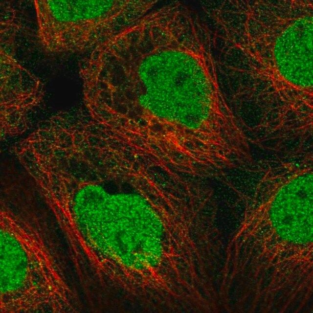 Anti-STK11 antibody produced in rabbit