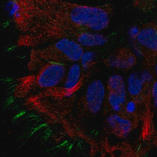 Anti-STOML3 antibody produced in rabbit
