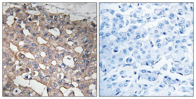 Anti-STMN1 antibody produced in rabbit