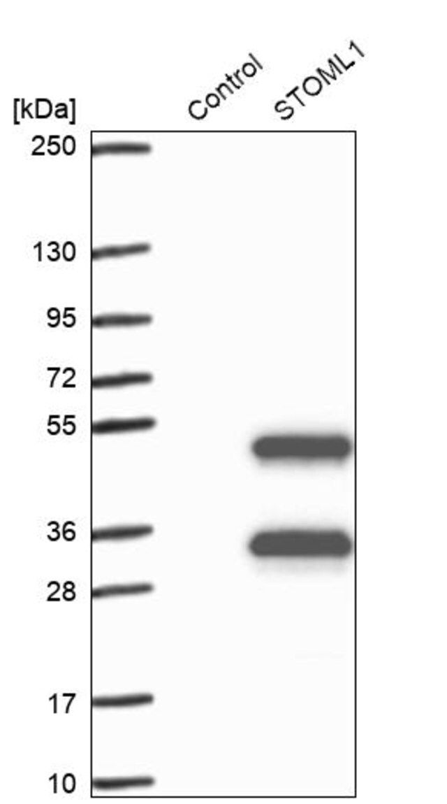Anti-STOML1 antibody produced in rabbit