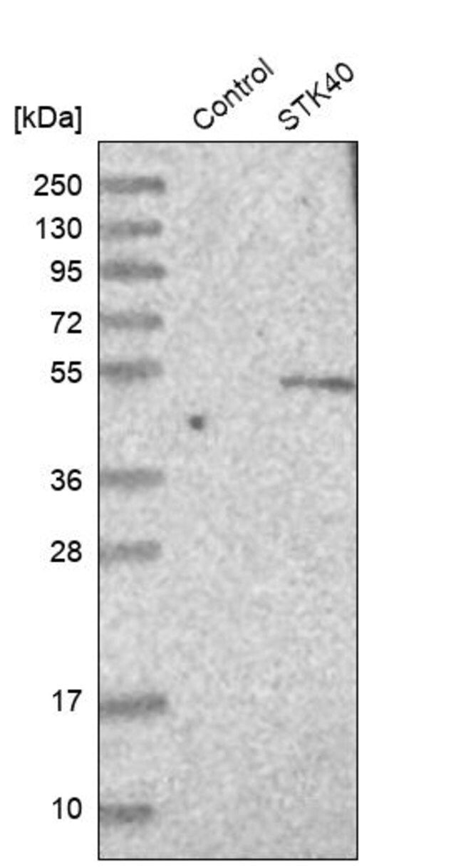 Anti-STK40 antibody produced in rabbit
