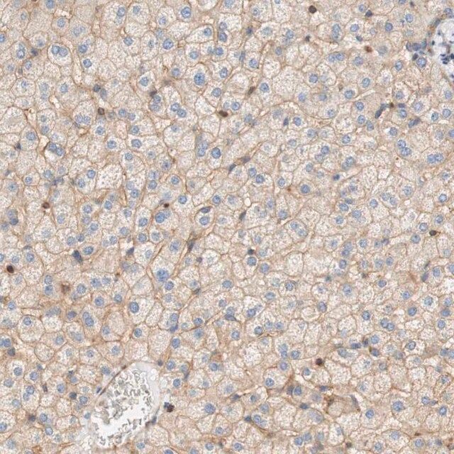 Anti-STOM antibody produced in rabbit
