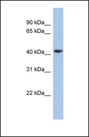 Anti-STOML3 antibody produced in rabbit