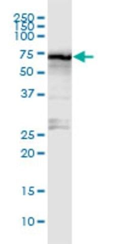Anti-STRA6 antibody produced in rabbit