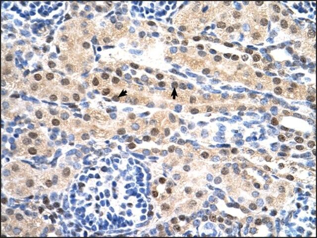 Anti-SULF2