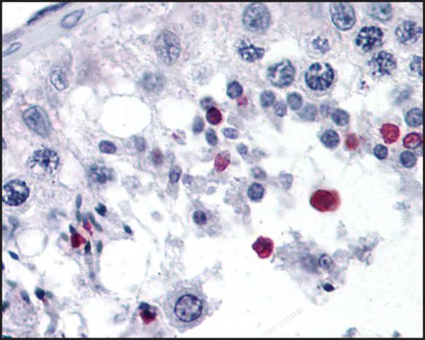 Anti-SPANXC (AB2) antibody produced in rabbit