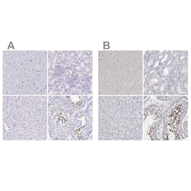Anti-SPACA1 antibody produced in rabbit