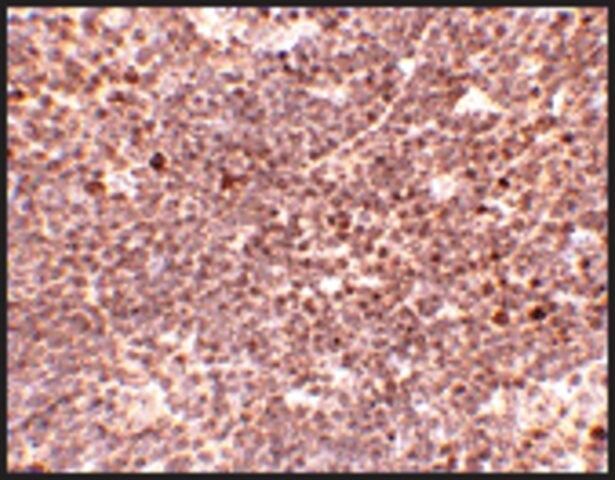 Anti-S1P1 antibody produced in rabbit