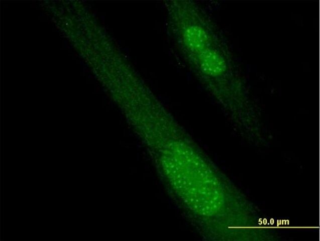Anti-SPANXB1 antibody produced in mouse
