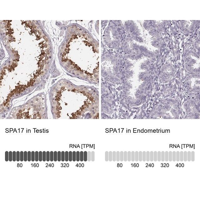 Anti-SPA17 antibody produced in rabbit