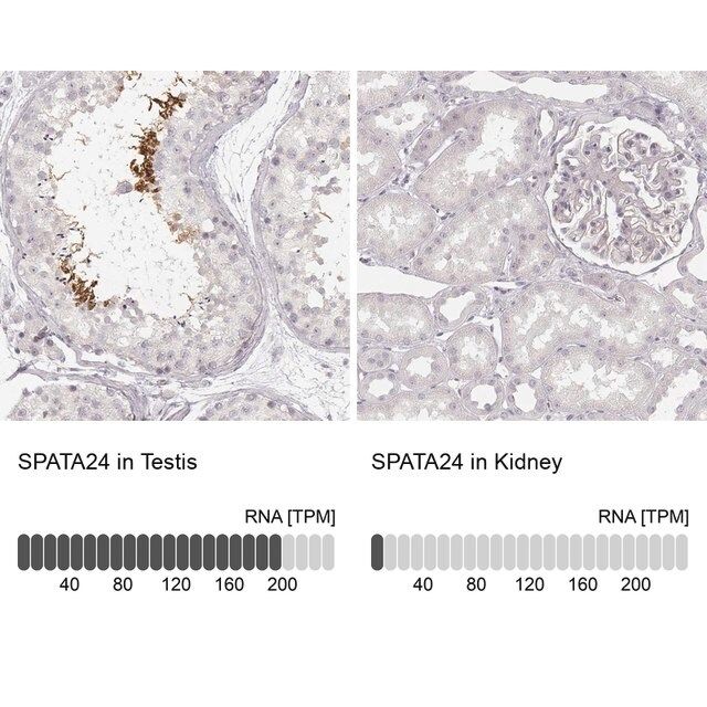 Anti-SPATA24 antibody produced in rabbit