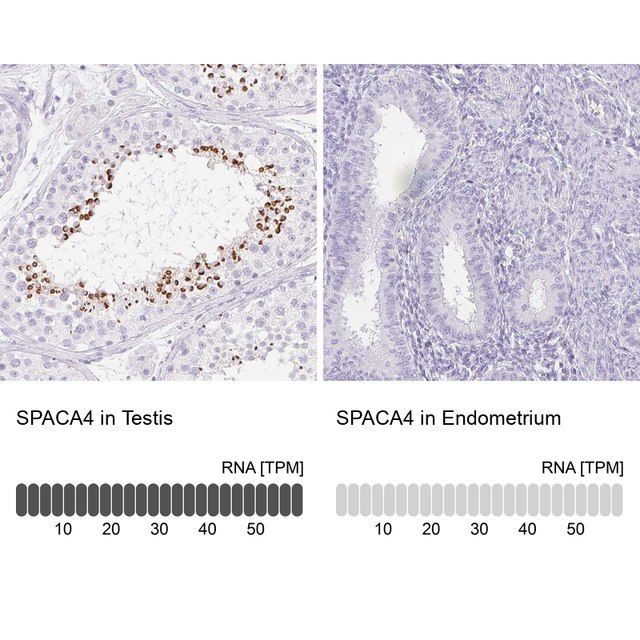 Anti-SPACA4 antibody produced in rabbit