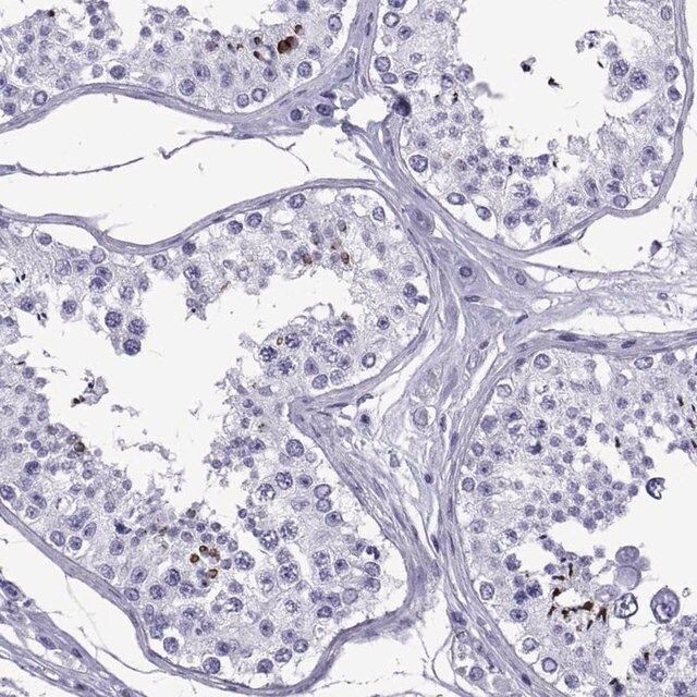 Anti-SPANXC antibody produced in rabbit