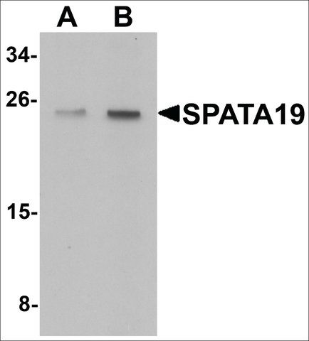 Anti-SPATA19 antibody produced in chicken