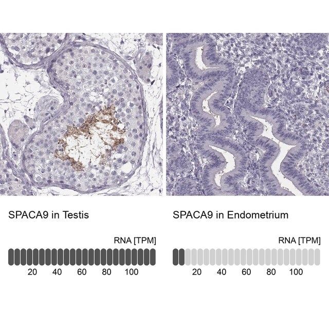 Anti-SPACA9 antibody produced in rabbit