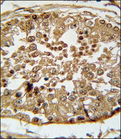ANTI-SPAG1 (N-TERM) antibody produced in rabbit