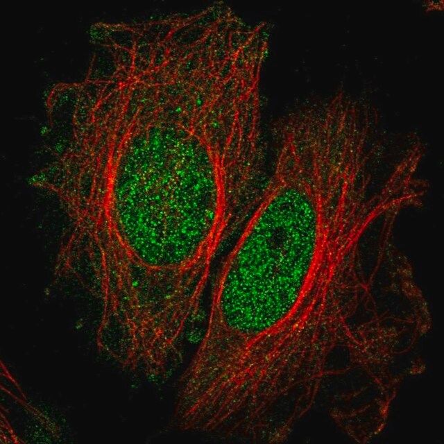 Anti-SPATA33 antibody produced in rabbit