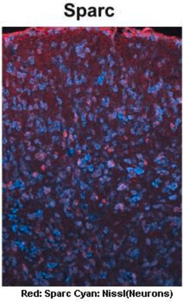 Anti-SPARC (C-terminal) antibody produced in rabbit