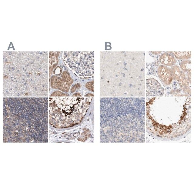 Anti-SPATA20 antibody produced in rabbit