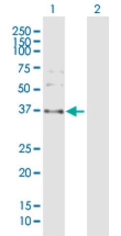 Anti-SPARC antibody produced in rabbit