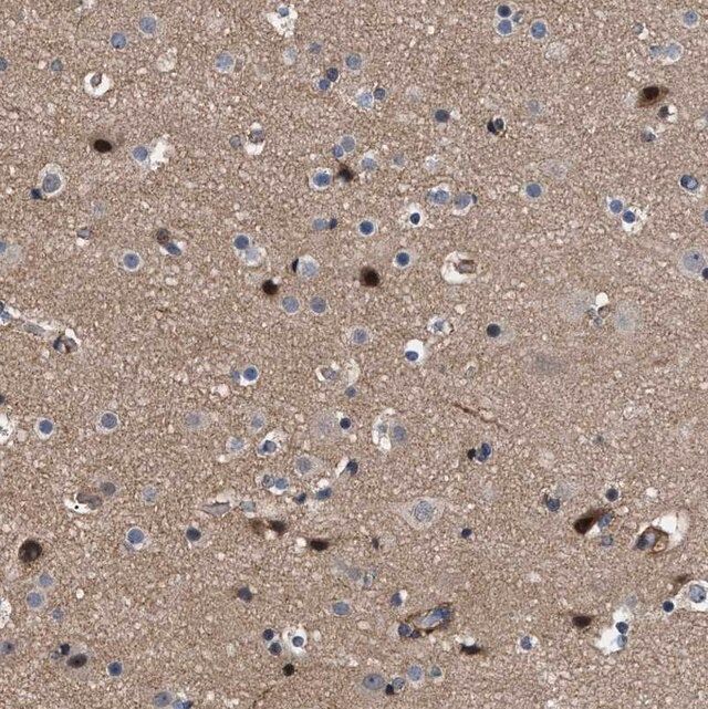 Anti-SPAST antibody produced in rabbit