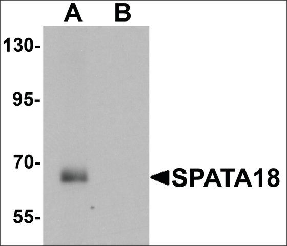 Anti-SPATA18 antibody produced in chicken