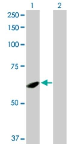 Anti-SPATA2 antibody produced in rabbit