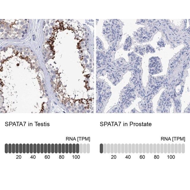 Anti-SPATA7 antibody produced in rabbit