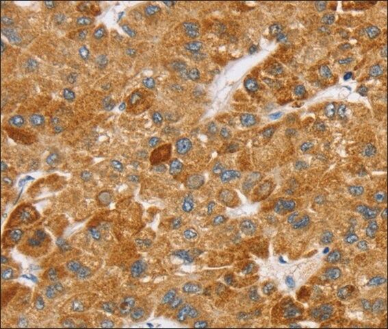 Anti-SPARCL1