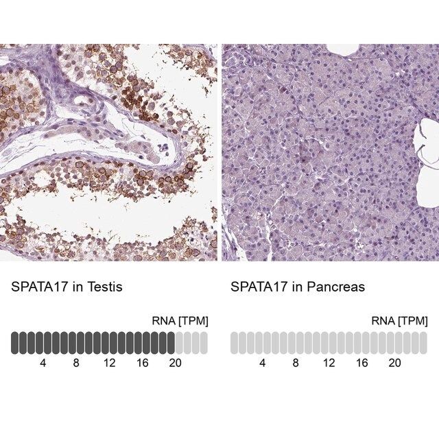 Anti-SPATA17 antibody produced in rabbit