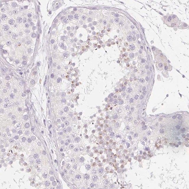 Anti-SPACA5B antibody produced in rabbit