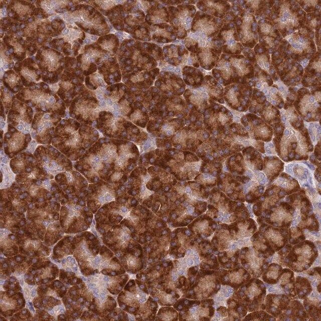 Anti-SPATA2 antibody produced in rabbit