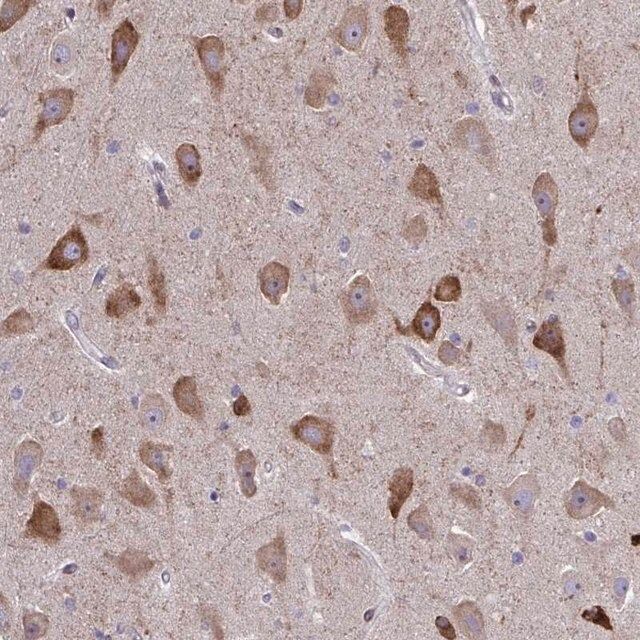 Anti-SPATS2L antibody produced in rabbit