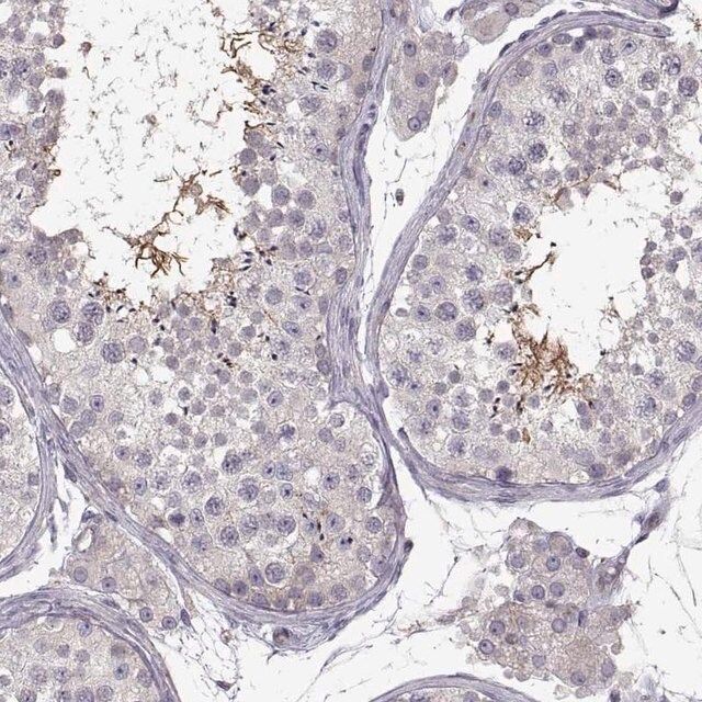 Anti-SPATA32 antibody produced in rabbit