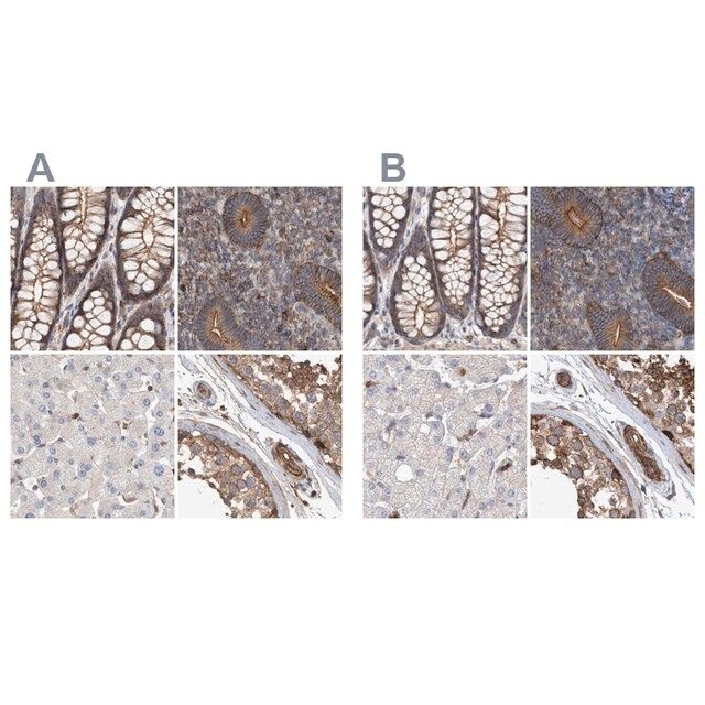 Anti-SPECC1 antibody produced in rabbit