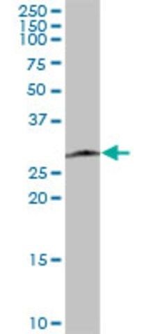 Anti-SPBC25 antibody produced in mouse