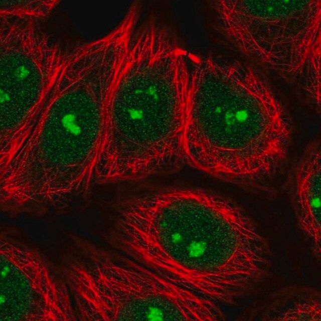 Anti-SPATA2 antibody produced in rabbit