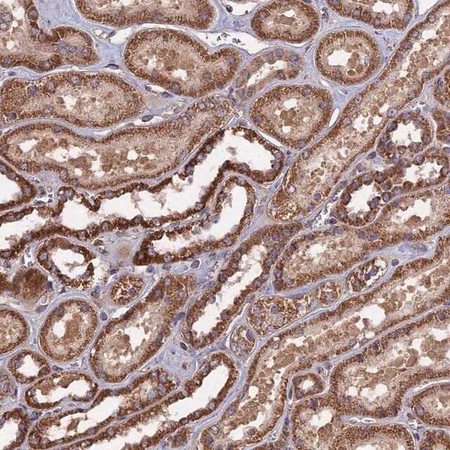 Anti-SPANXN4 antibody produced in rabbit