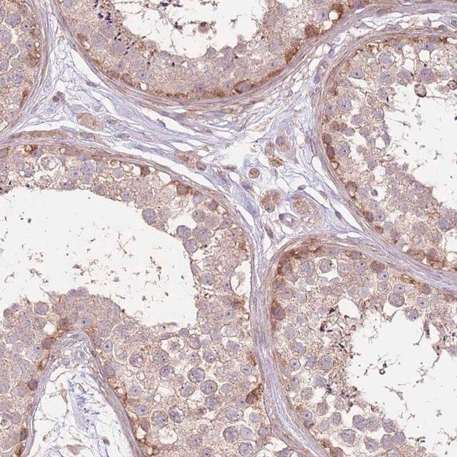 Anti-SPATA31D1 antibody produced in rabbit