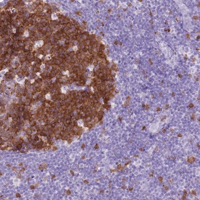 Anti-SPC25 antibody produced in rabbit