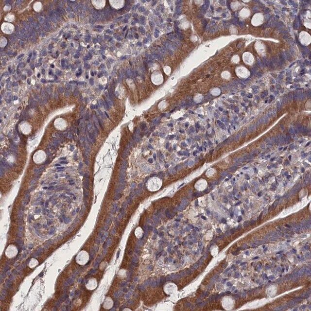 Anti-SPATA13 antibody produced in rabbit