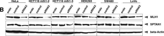 Anti-Spectrin alpha chain (nonerythroid) Antibody, clone AA6