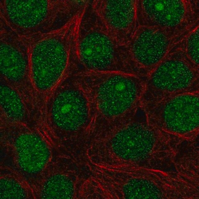 Anti-SPDEF antibody produced in rabbit