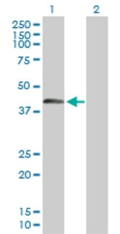 Anti-SPESP1 antibody produced in mouse