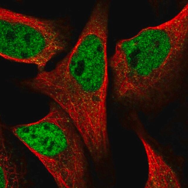 Anti-SPIDR antibody produced in rabbit