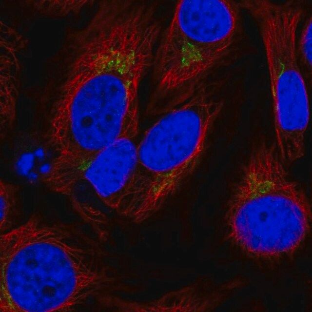 Anti-SPCS1 antibody produced in rabbit